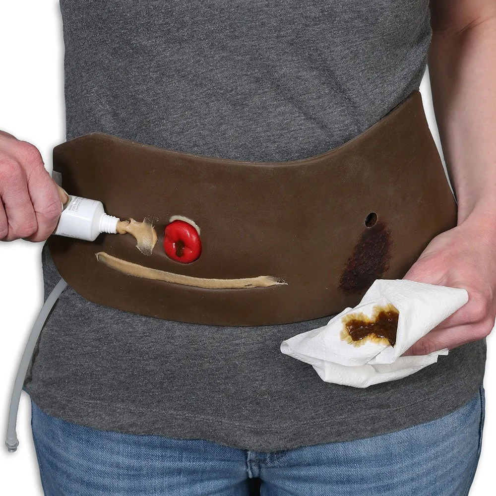 Ostomy Pouching Trainer, Dark Skin